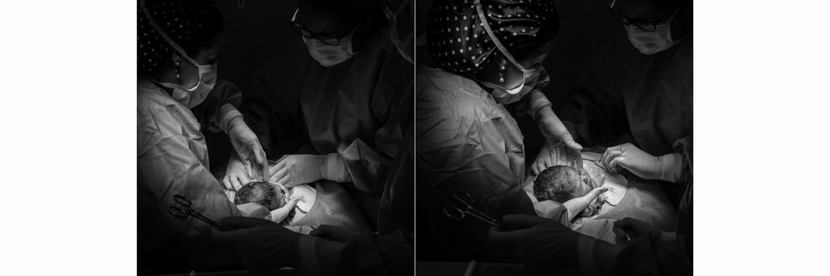 nascimento, fotografia de parto, parto, fotos de nascimento, fotos de nascimento em niterói, nascimento hospital cnh, hospital csh niterói