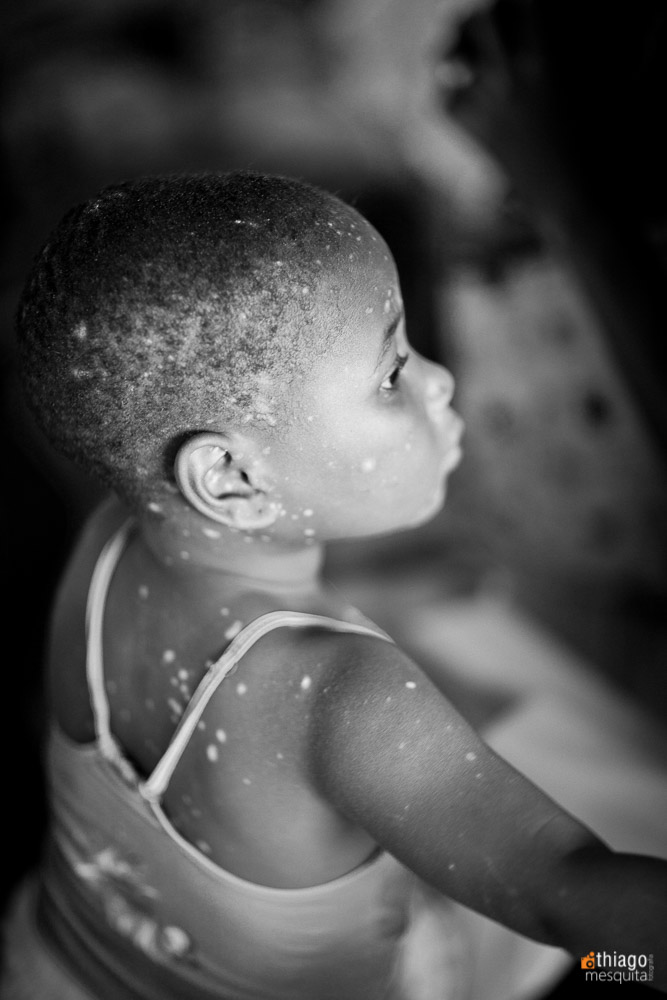 feridas pelo corpo - doenças primárias básicas na áfrica