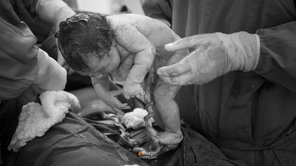 Fotografia de Parto. Clinica Santa Clara