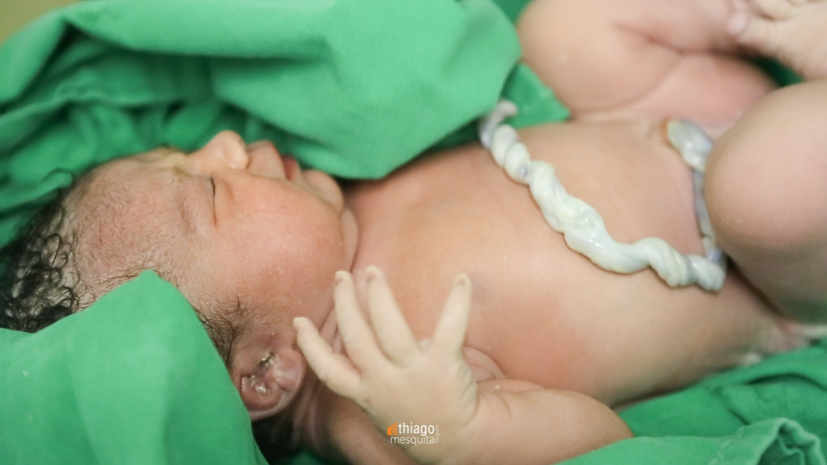 Fotografia de Parto. Clinica Santa Clara