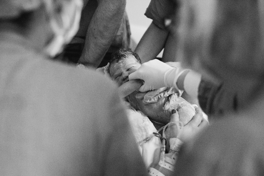 fotografia de parto normal