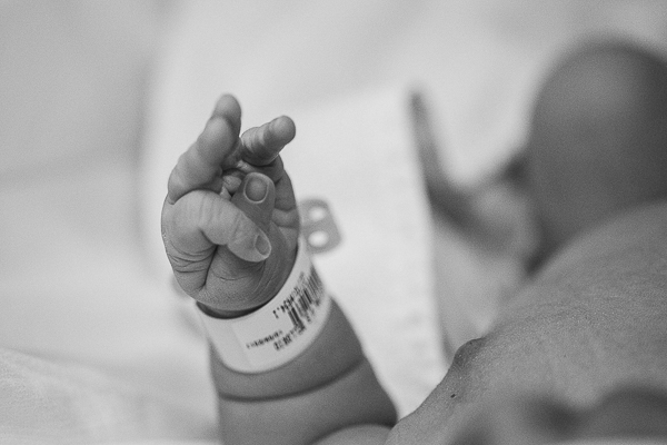 detalhes da fotografia de parto