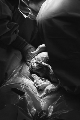 fotografia de parto no einstein