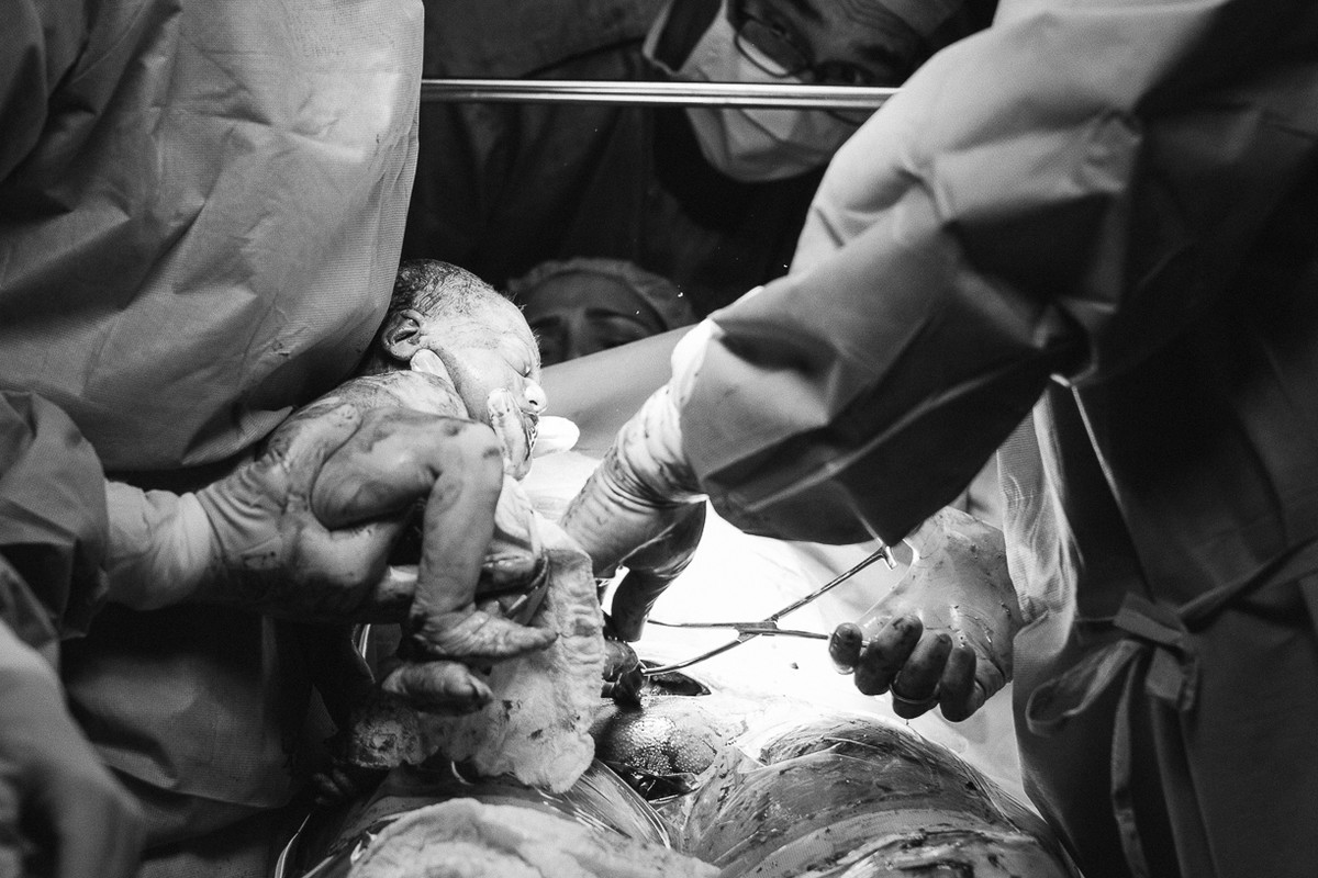 acompanhamento fotografico do parto