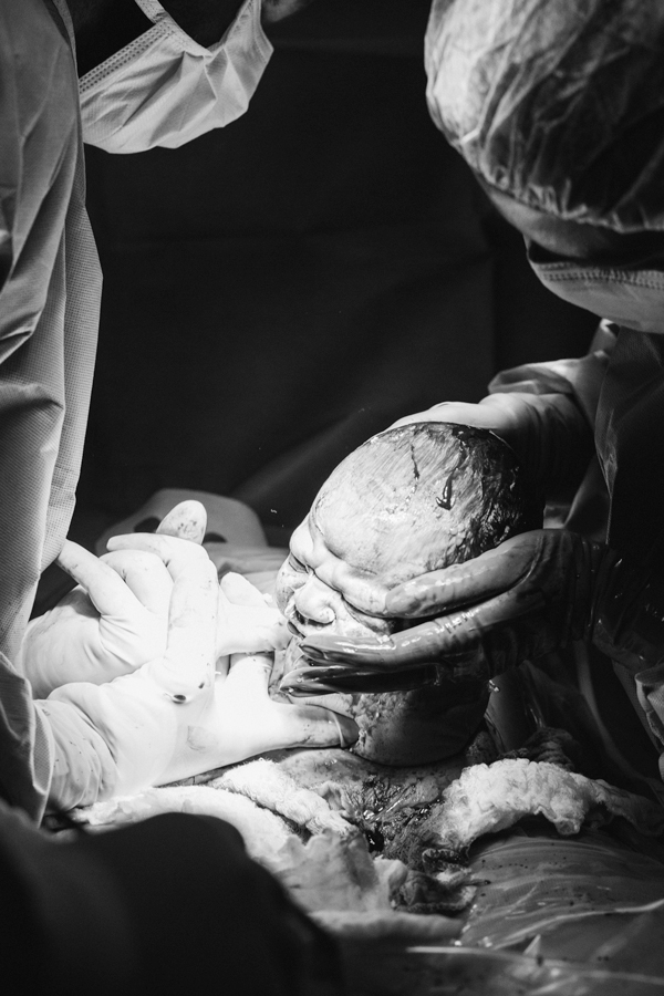 cesaria humanizada no einstein