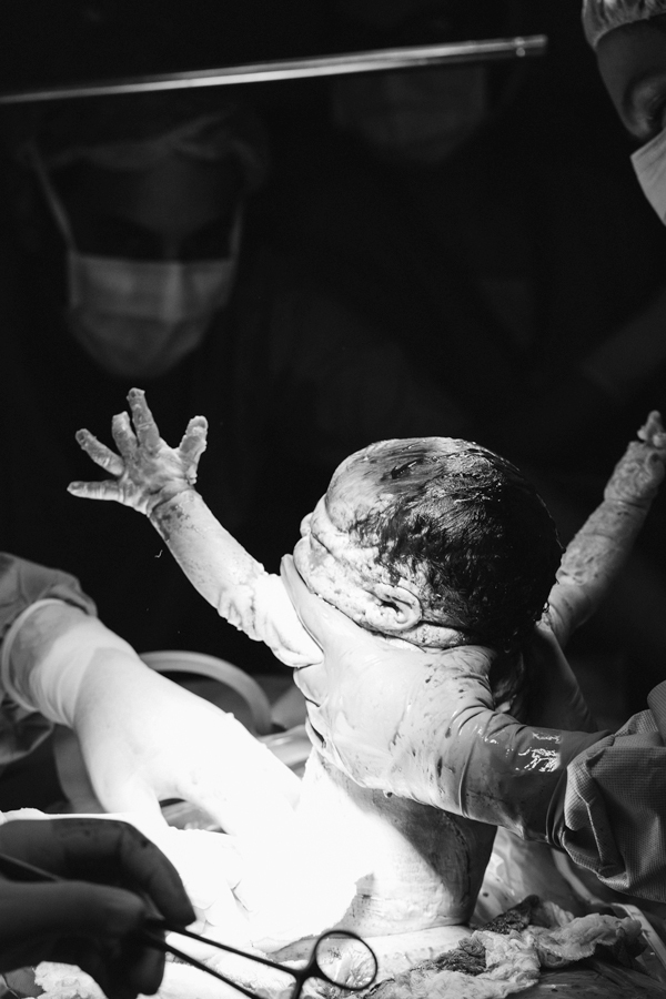 cesaria humanizada dra heloisa brudniewski