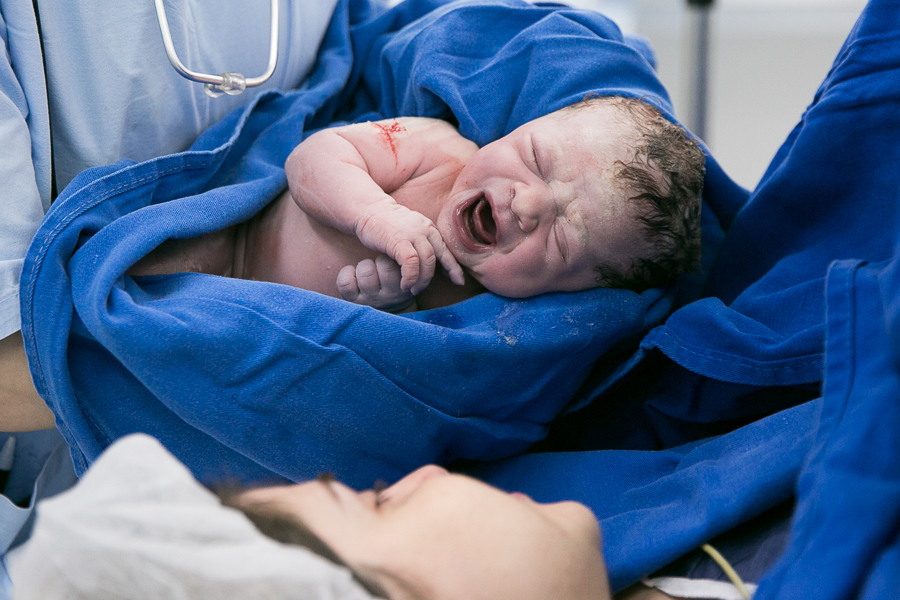 registro fotografico de parto