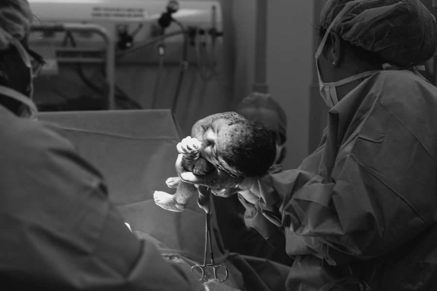 FOTOGRAFIA DE PARTO- CESARIANA