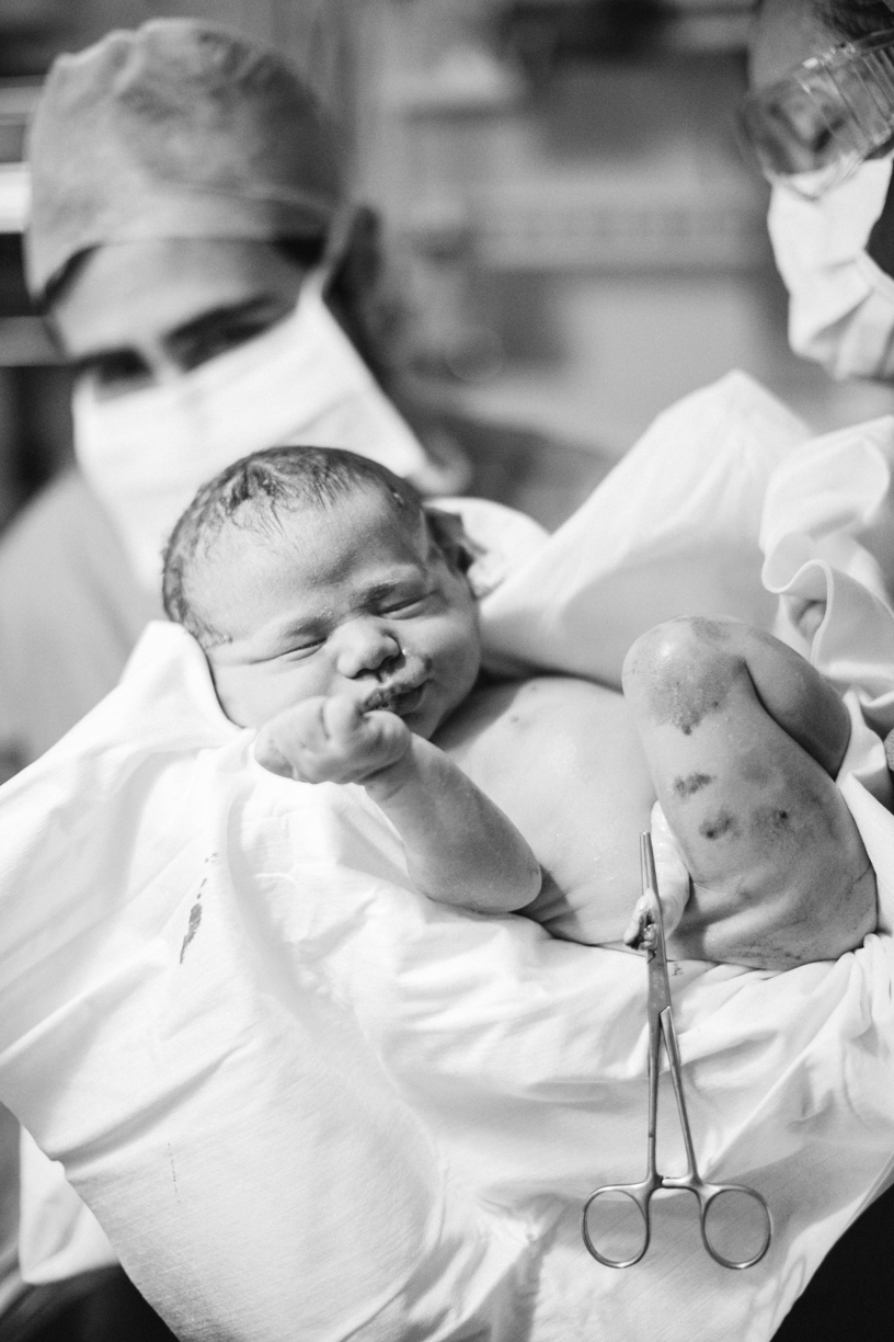 parto cesaria - maternidade albert einstein