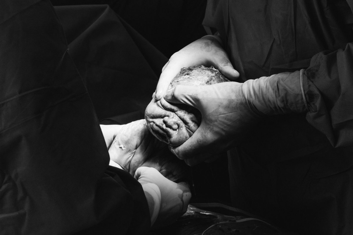 contratando um fotografo para um parto de cesaria