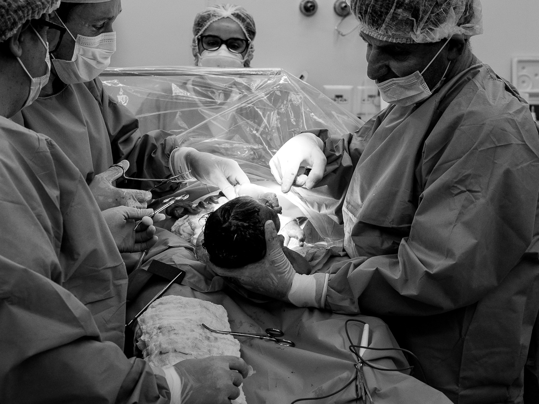 fotografia de parto bebê nascendo