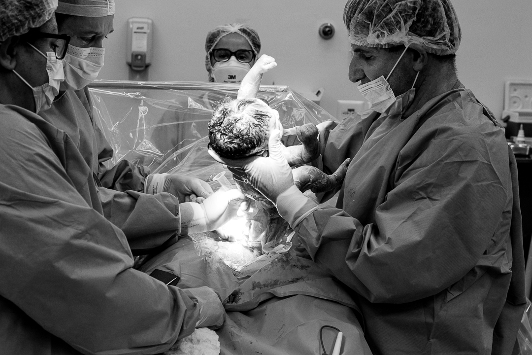 fotografia de parto retirando bebe da barriga