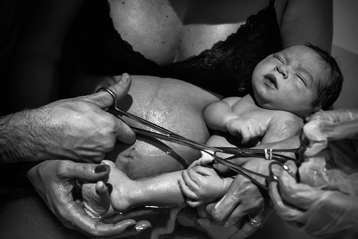 Adriana Costa fotografou cordão umbilical sendo cortado pelo pai