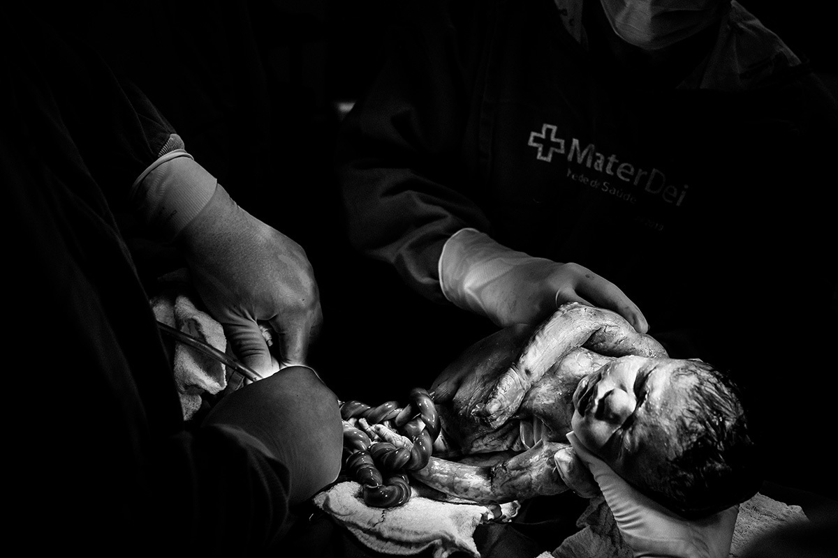 bebê nascendo por cesárea, em foto de Adriana Costa