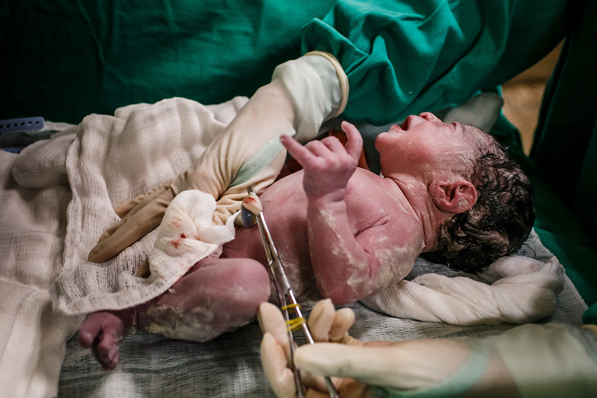 bebê sendo examinado após o corte do cordão umbilical