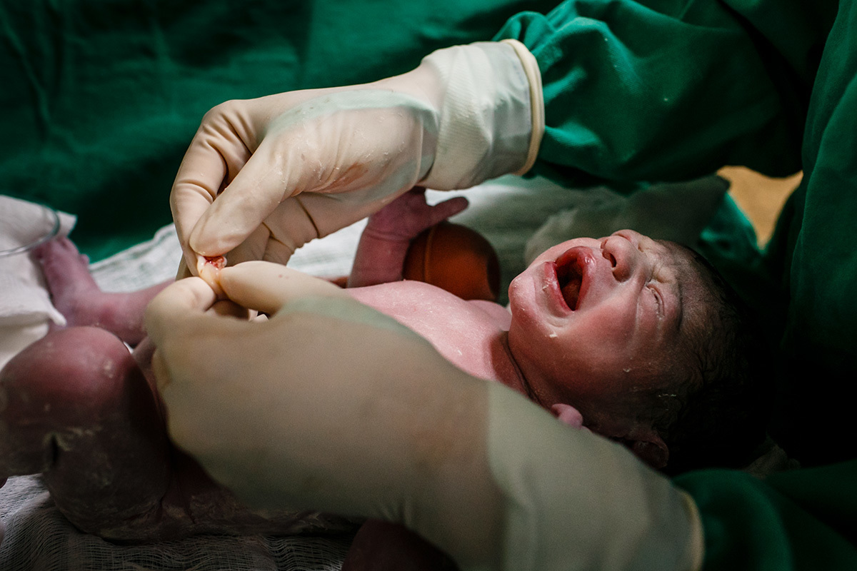 enfermeira examina o cordão umbilical do bebê após o corte, por Adriana Costa