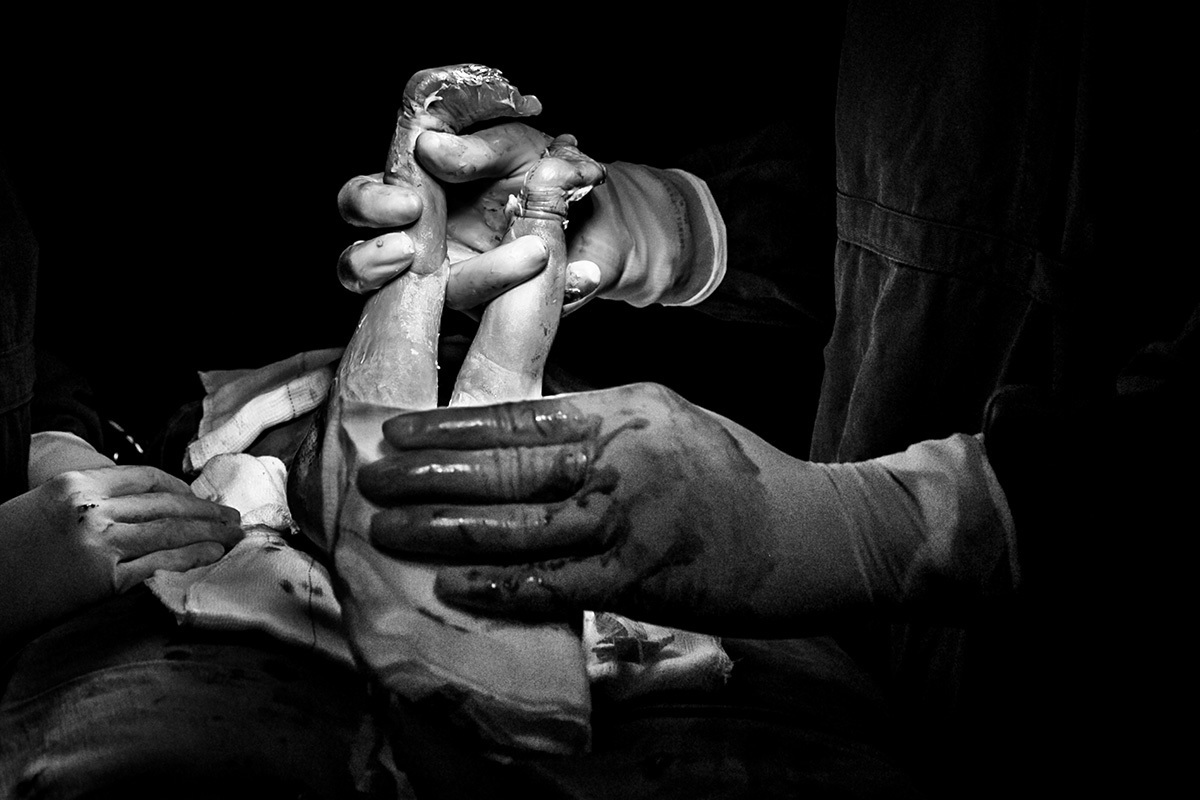 nascimento bebê pélvico em foto de Adriana Costa