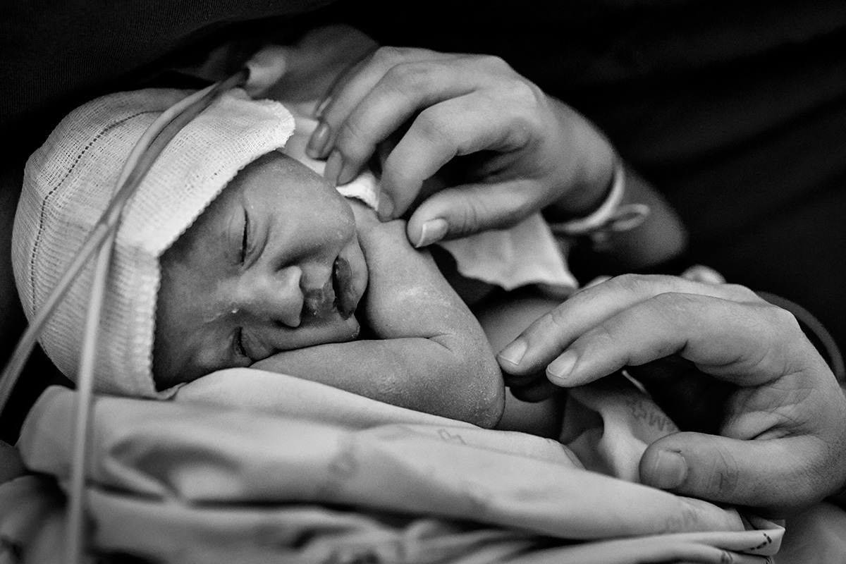 bebê recebendo carinho dos pais logo após o nascimento