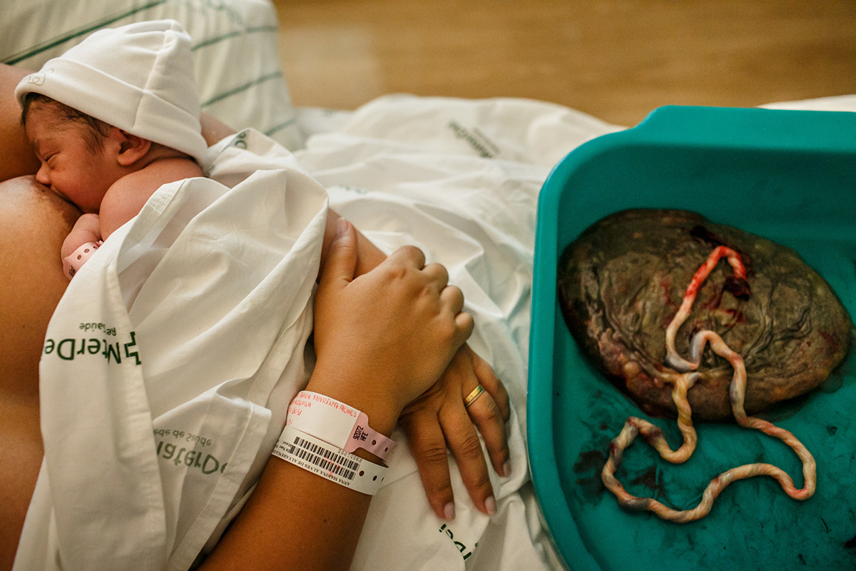 bebê amamentando ao lado da placenta