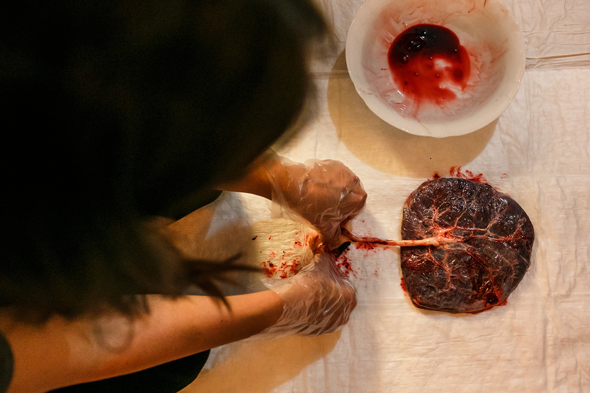 doula realizando o print da placenta