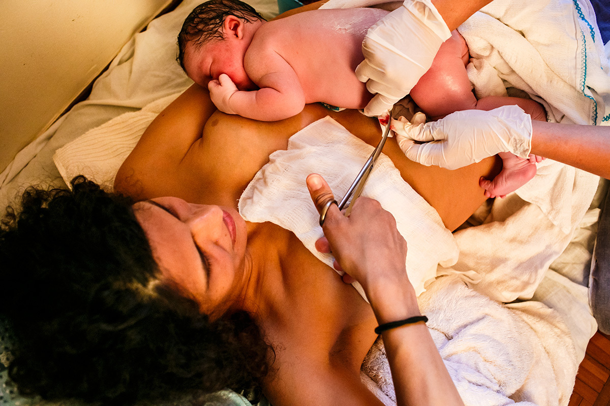 corte do cordão umbilical após um parto domiciliar com assistência da Equipe Bom Parto