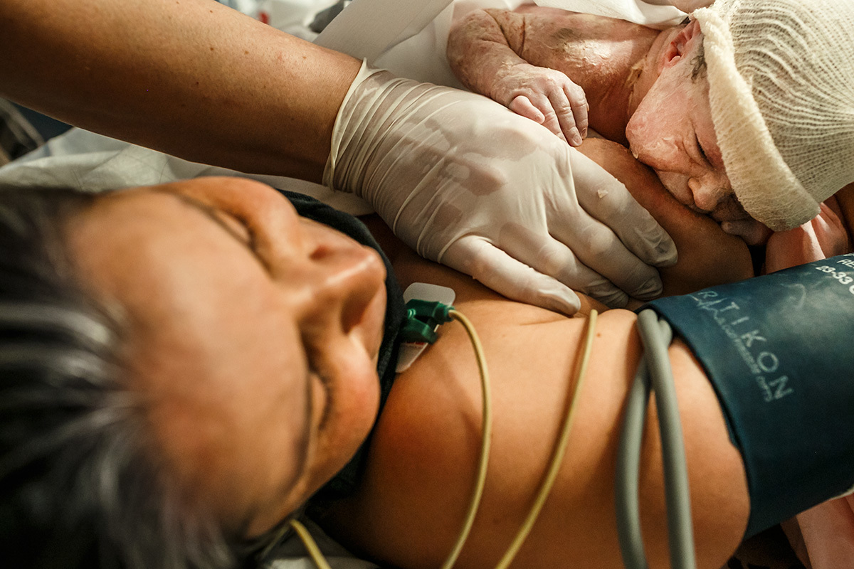 bebê amamentando na hora de ouro após cesárea