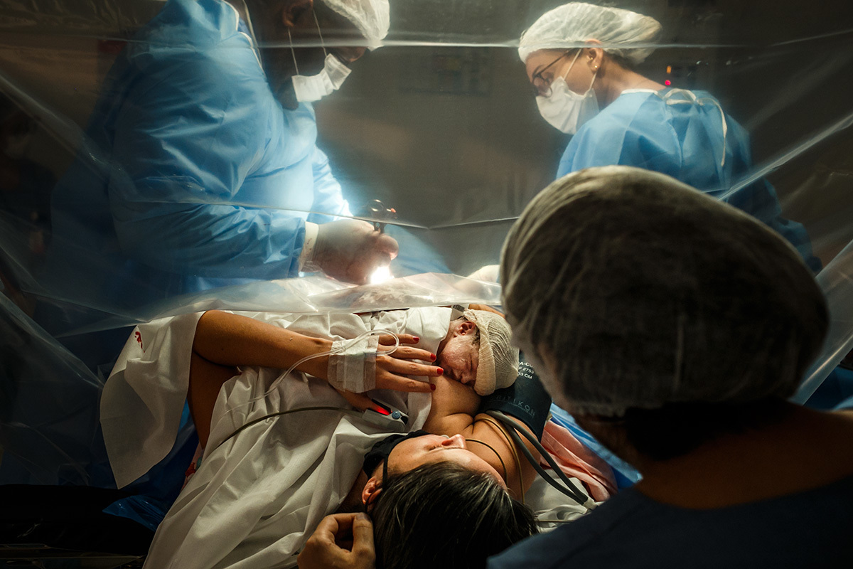 casal com sua bebê na Hora de Ouro enquanto obstetra finaliza cesárea