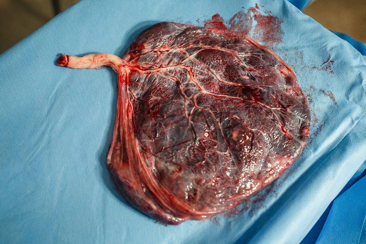 placenta