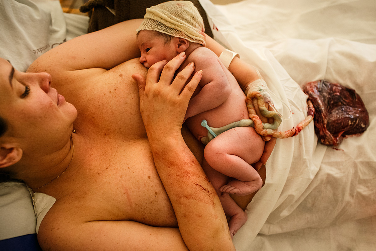 mãe amamentando bebê com o cordão umbilical ainda ligado a placenta após o nascimento durante a Hora de Ouro em foto de Adriana Costa