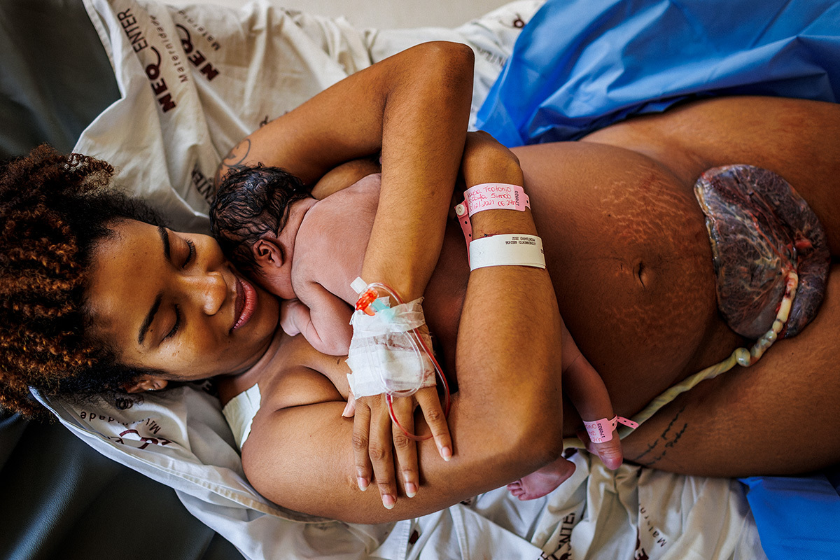 foto da mãe e sua bebê ainda ligada a placenta