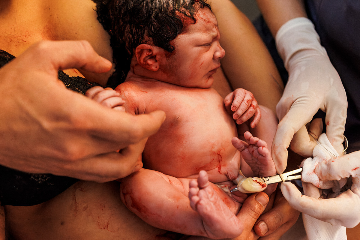 enfermeira cuidando do cordão umbilical do bebê após o corte