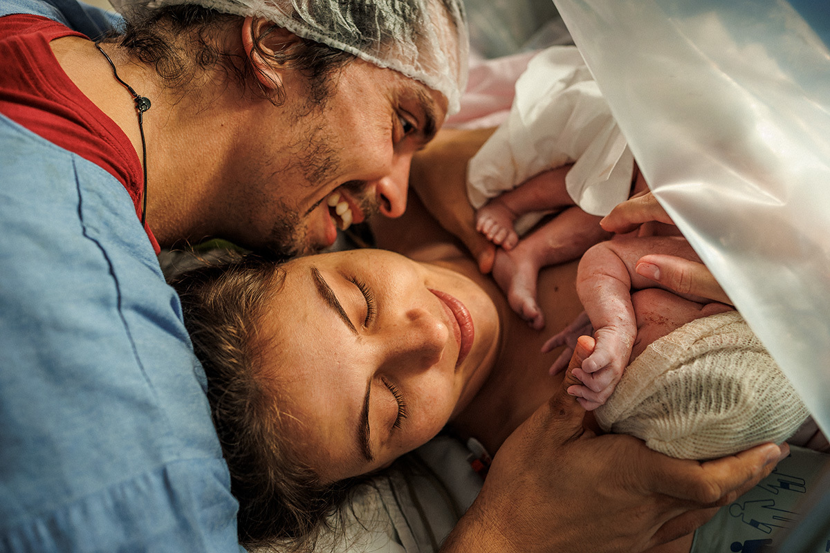 contato pele a pele após cesárea