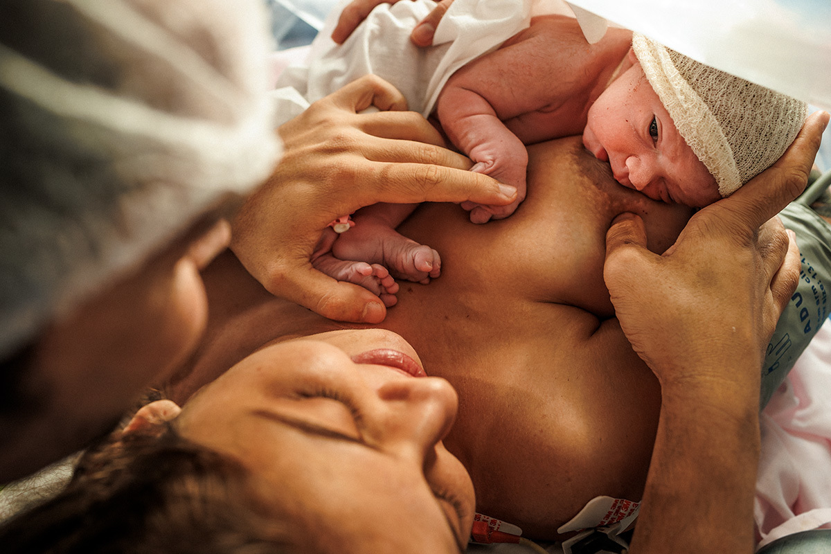 amamentação após cesárea durante a hora de ouro
