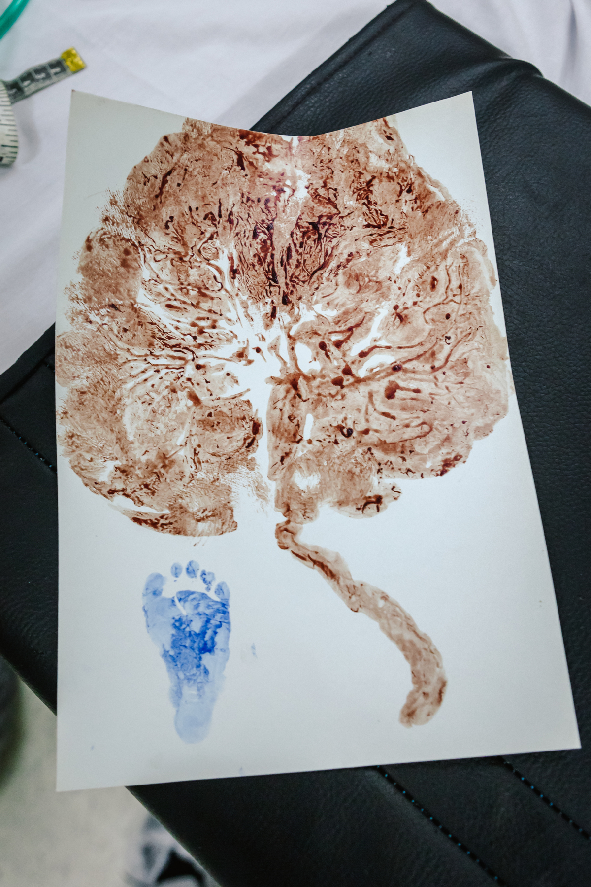 Parto maternidade perinatal, Fotografa de parto rio de janeiro, fotografo de parto, parto cesárea, parto, nascimento, foto, fotografia, rio de janeiro, rj, li marques fotografia