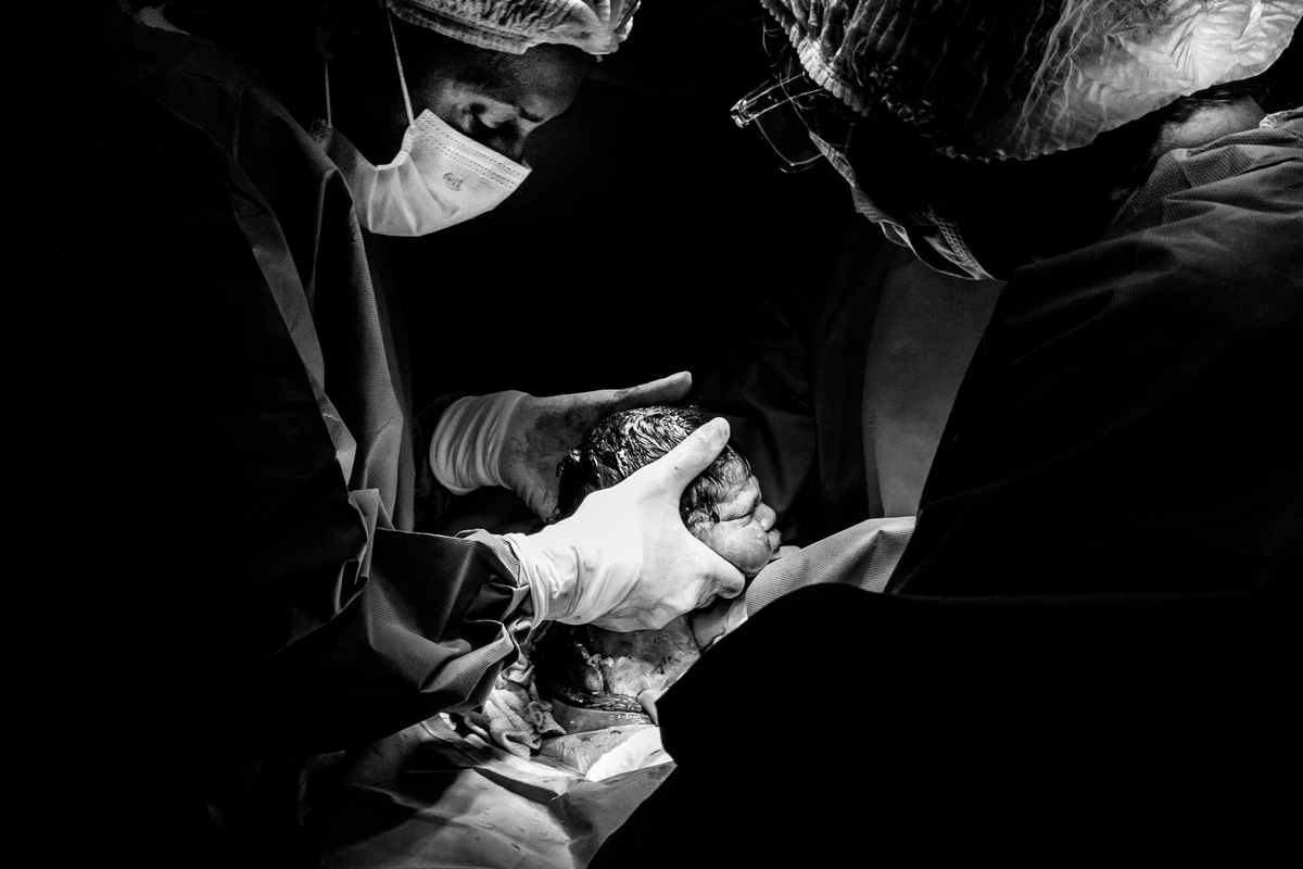 Parto maternidade perinatal, Fotografa de parto rio de janeiro, fotografo de parto, fotografia cesárea, cesárea, parto, cesariana, nascimento, foto, fotografia, rio de janeiro, rj, li marques fotografia