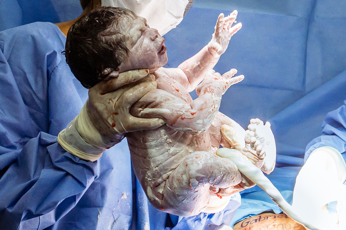 Parto maternidade perinatal, Fotografa de parto rio de janeiro, fotografo de parto, fotografia cesárea, cesárea, parto, cesariana, nascimento, foto, fotografia, rio de janeiro, rj, li marques fotografia