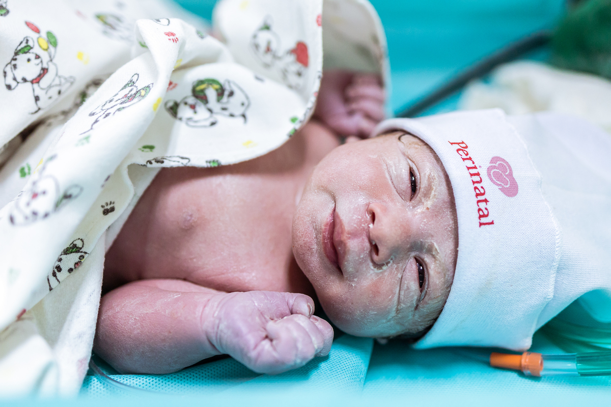 Parto maternidade perinatal, Fotografa de parto rio de janeiro, fotografo de parto, fotografia cesárea, cesárea, parto, cesariana, nascimento, foto, fotografia, rio de janeiro, rj, li marques fotografia