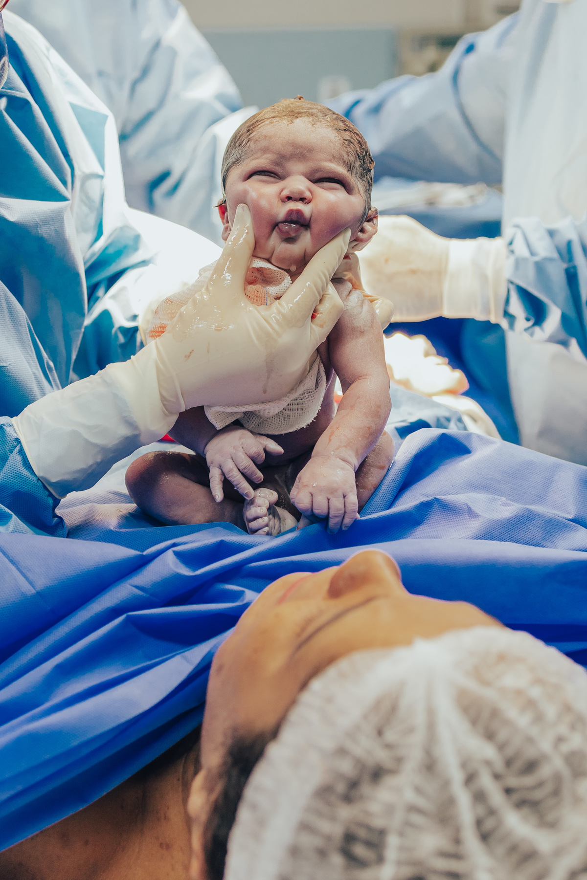 cesárea, cesárea, parto, cesariana, nascimento, foto, fotografia, rio de janeiro, rj, li marques fotografa