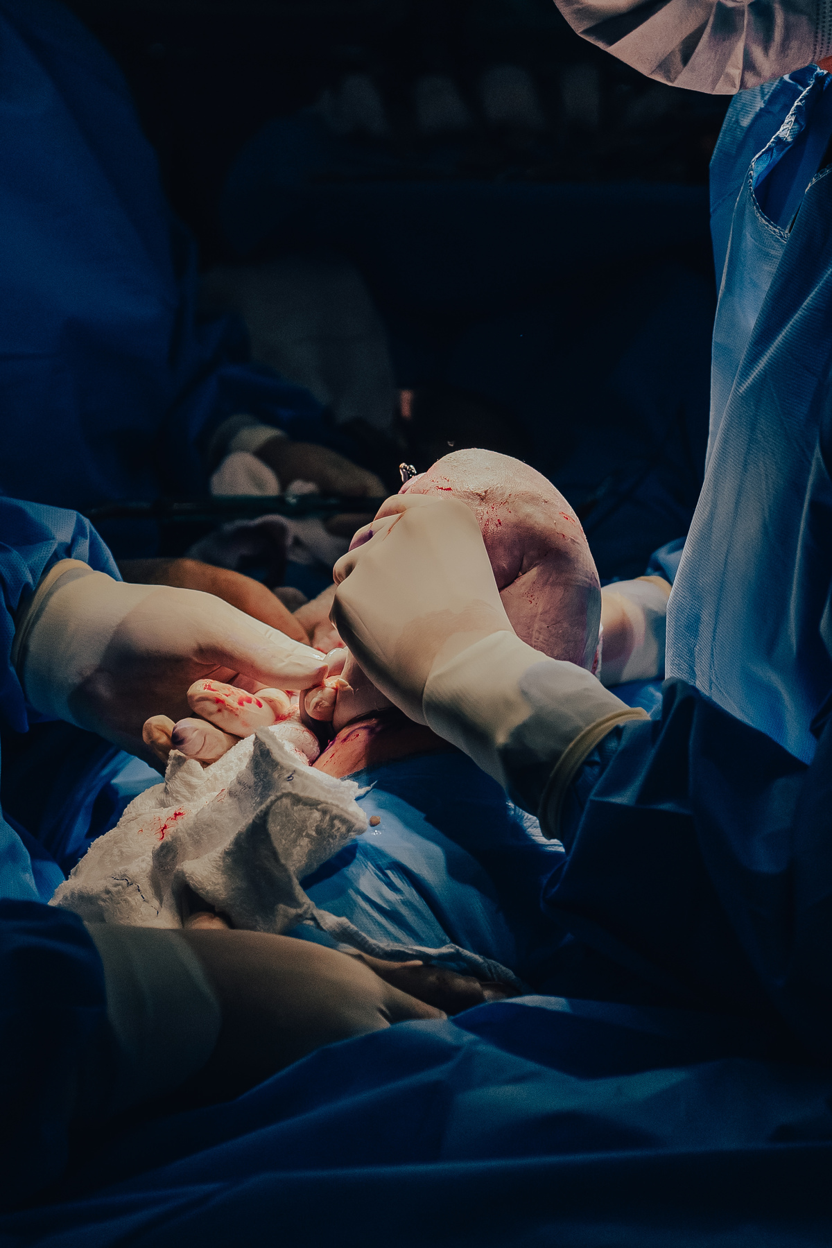 Parto pélvico, Parto maternidade perinatal, Fotografa de parto rio de janeiro, fotografo de parto, parto cesárea, parto, nascimento, foto, fotografia, rio de janeiro, rj, li marques fotografia