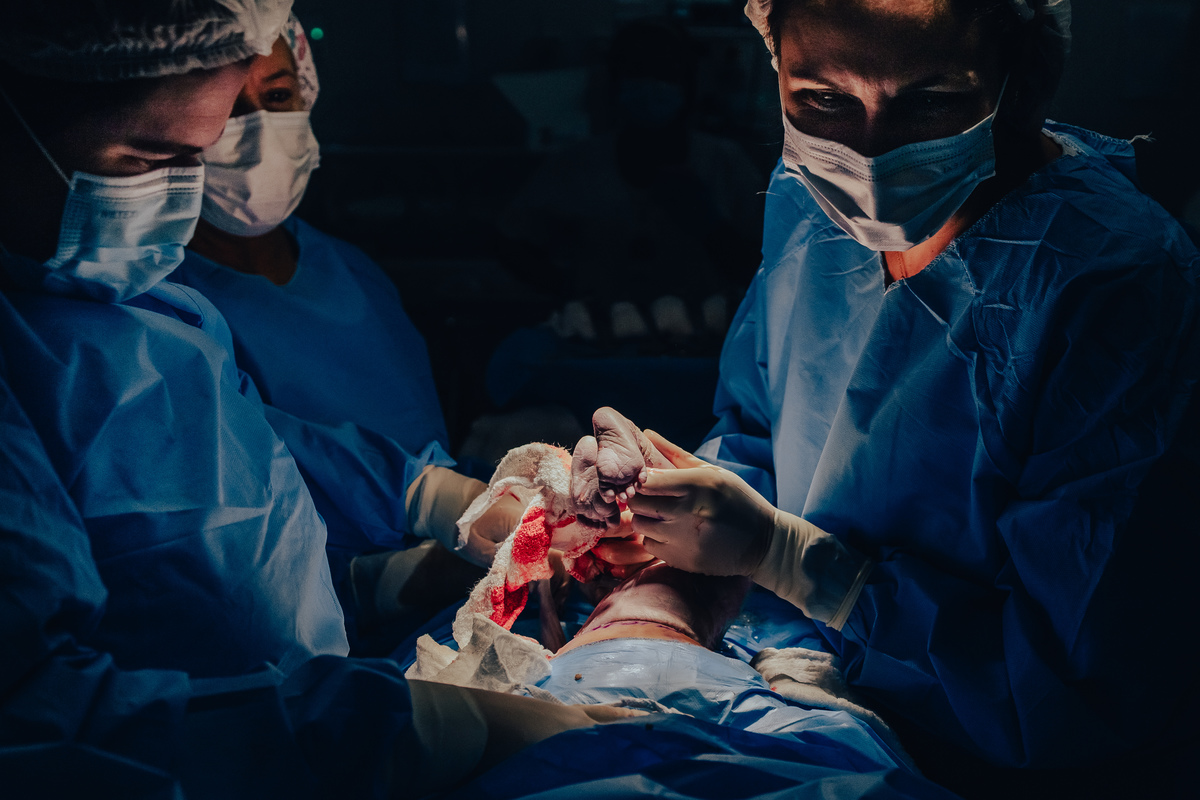 Parto pélvico, Parto maternidade perinatal, Fotografa de parto rio de janeiro, fotografo de parto, parto cesárea, parto, nascimento, foto, fotografia, rio de janeiro, rj, li marques fotografia