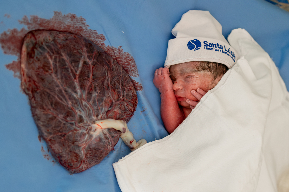 Parto maternidade Santa Lúcia, Fotografa de parto rio de janeiro, fotografo de parto, parto normal, Parto natural, parto humanizado, parto, nascimento, foto, fotografia, rio de janeiro, rj, li marques fotografia, plancenta