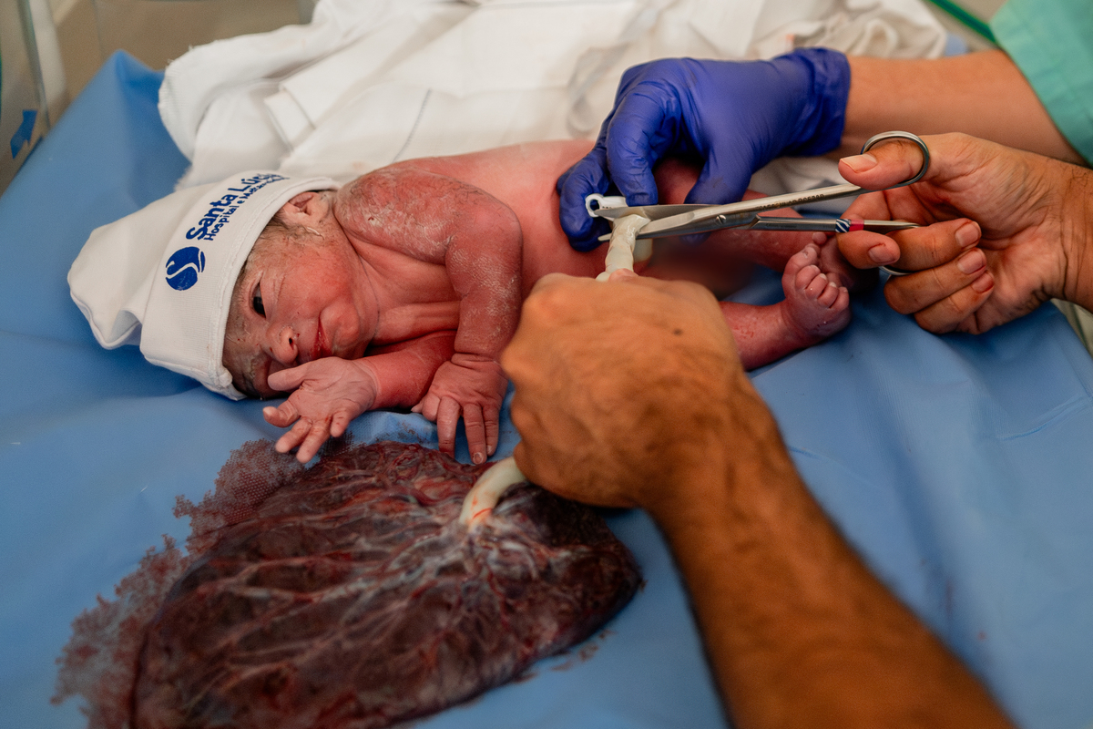 Parto maternidade Santa Lúcia, Fotografa de parto rio de janeiro, fotografo de parto, parto normal, Parto natural, parto humanizado, parto, nascimento, foto, fotografia, rio de janeiro, rj, li marques fotografia, plancenta, corte do cordão umbilical