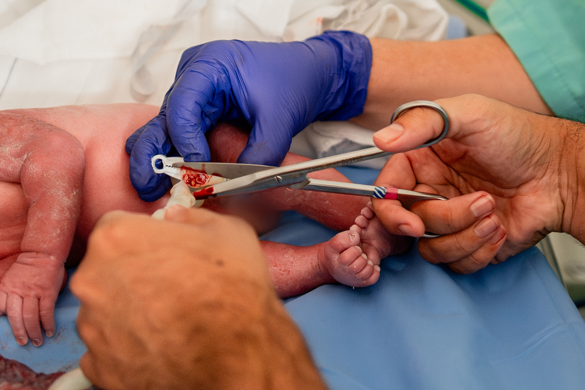 Parto maternidade Santa Lúcia, Fotografa de parto rio de janeiro, fotografo de parto, parto normal, Parto natural, parto humanizado, parto, nascimento, foto, fotografia, rio de janeiro, rj, li marques fotografia, corte do cordão umbilical