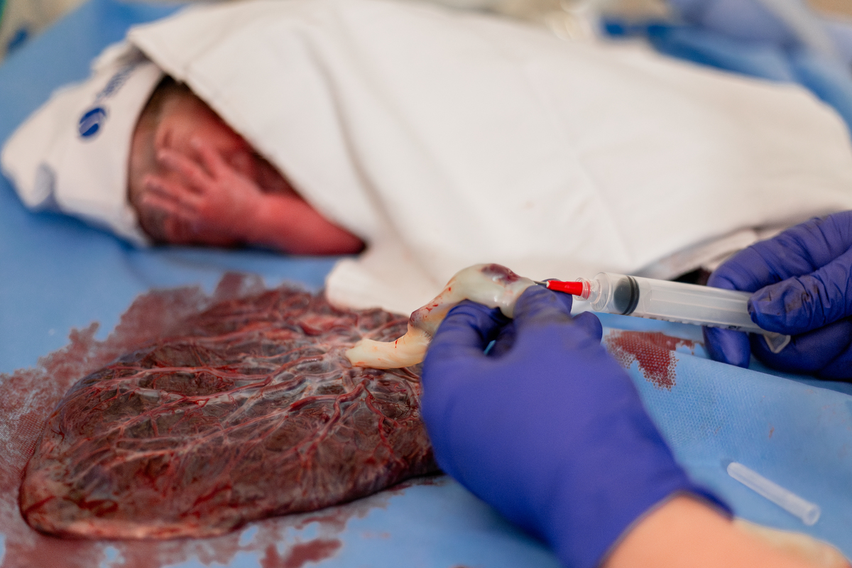 Parto maternidade Santa Lúcia, Fotografa de parto rio de janeiro, fotografo de parto, parto normal, Parto natural, parto humanizado, parto, nascimento, foto, fotografia, rio de janeiro, rj, li marques fotografia, plancenta