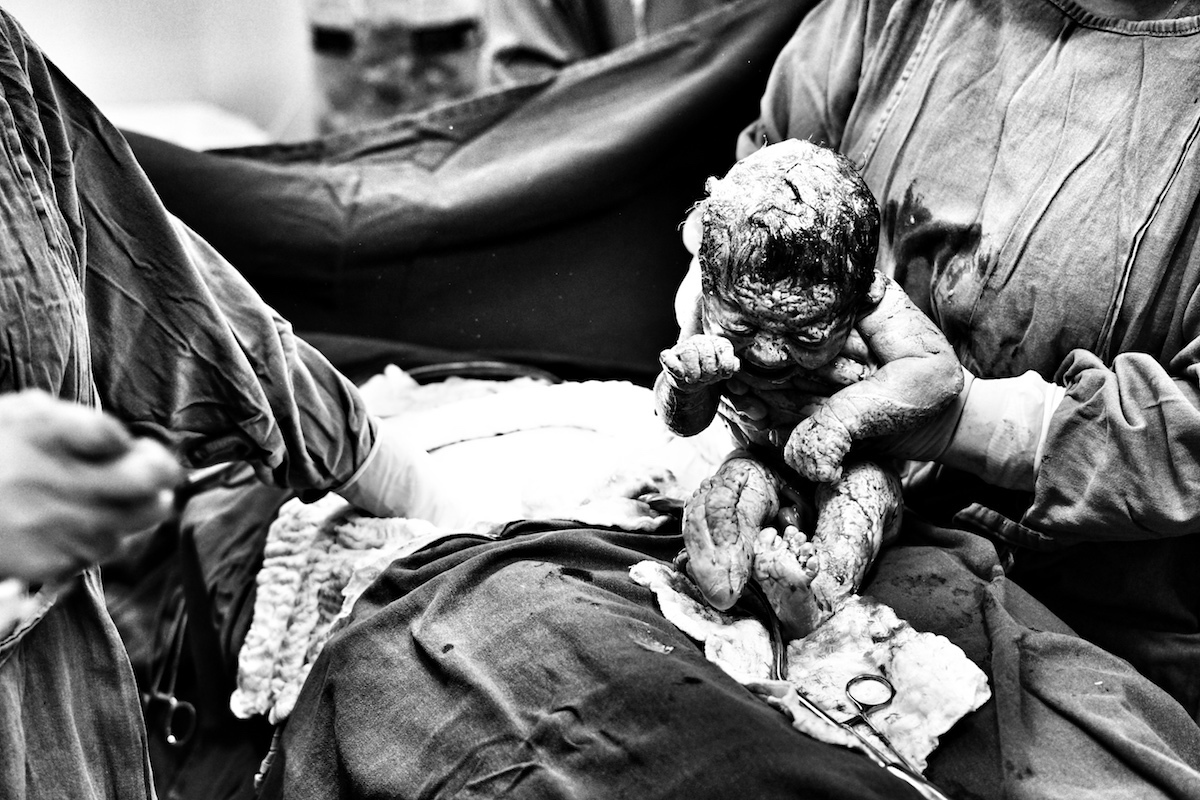 fotógrafo de parto, fotógrafo + de + parto, fotografia de parto, fotografia + de + parto, maternidade vitória, fotógrafo maternidade hospital vitória, fotógrafo de parto em são paulo, fotógrafo para parto humanizado, fotógrafo parto hospital