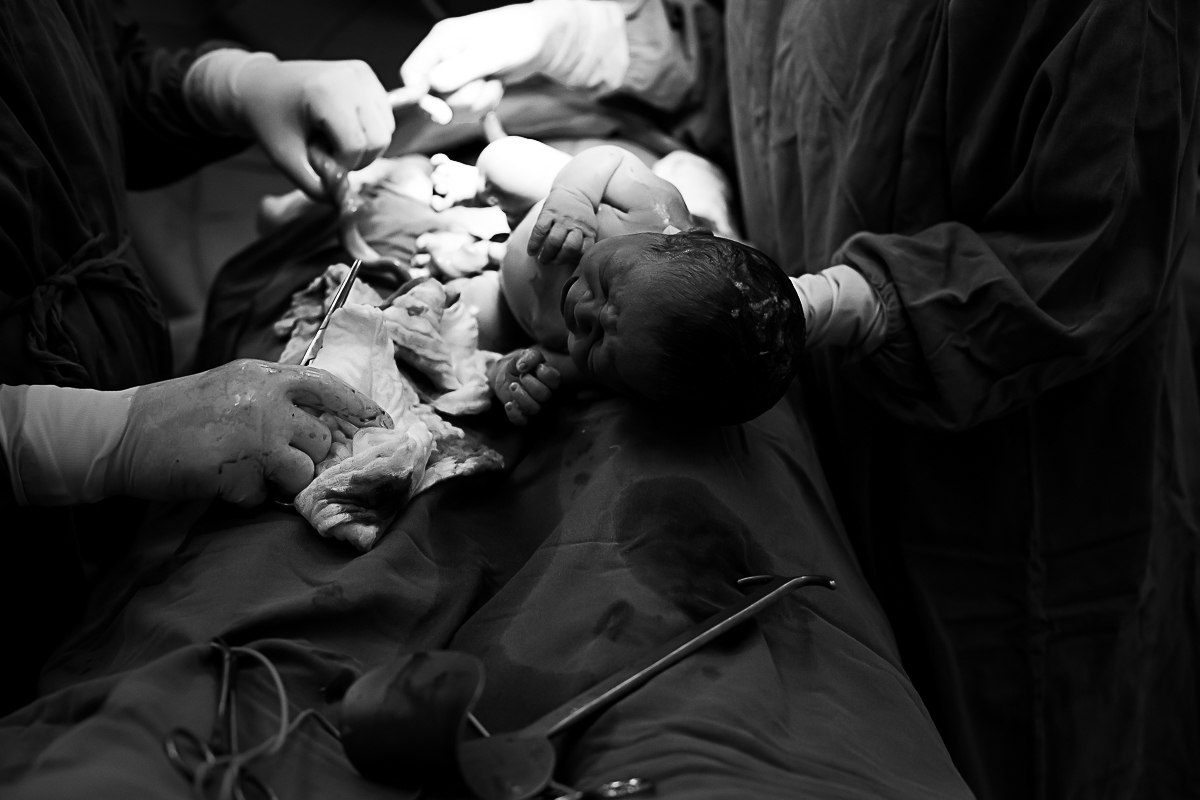 Hora do Paro cesariana.