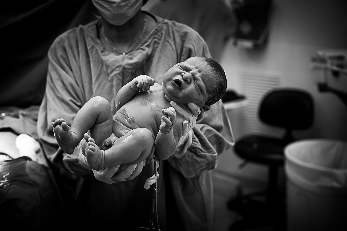 Após o nascimento do bebê, ele é apresentado ao pai ainda no centro cirurgico na maternidade SEPACO na Vila Mariana em São Paulo.