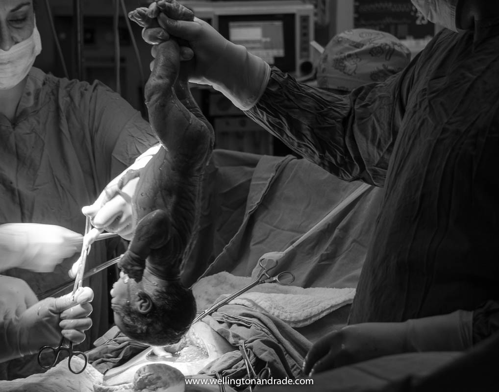 fotografia de parto, fotógrafo para parto, fotógrafo de parto, fotógrafo de parto hospital albert einstein, fotógrafo de casamento sp