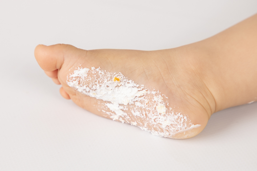 sessão fotos porto, sessão fotográfica bebés, smash cake porto, sessão smash the cake, fotografia, sessão aniversário porto, sessão 1 aniversario, fotos 1 aniversario, smash the cake aniversário