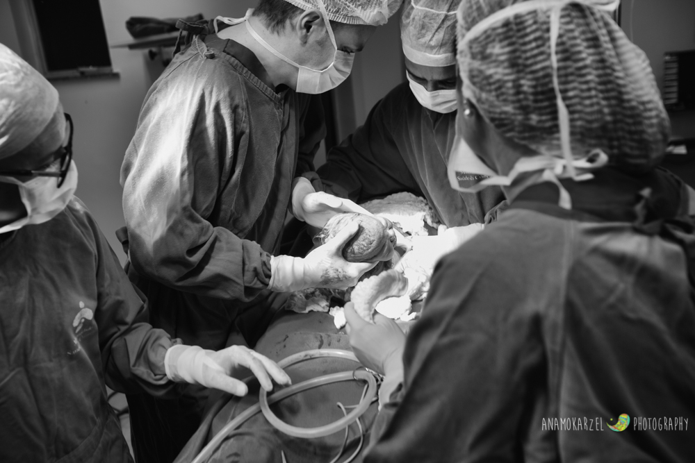 parto - fotografia de parto - anamokarzelfotografia - Ana Mokarzel - fotografia de família - fotógrafo d família - Belém - Pará